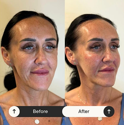 Skin treatment at The Aesthetics Suite aesthetics clinic Wilmslow